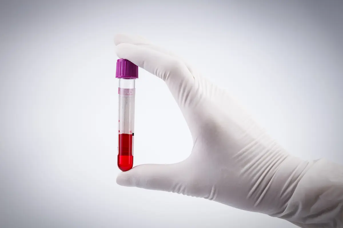 A hand holding a test tube with blood plasma representing the professional specimen collection and careful handling that a qualified mobile phlebotomy service delivers during every at-home blood draw visit